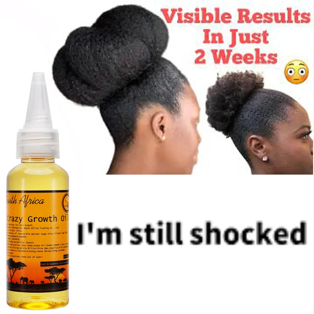 African Layden Hair Growth Oil